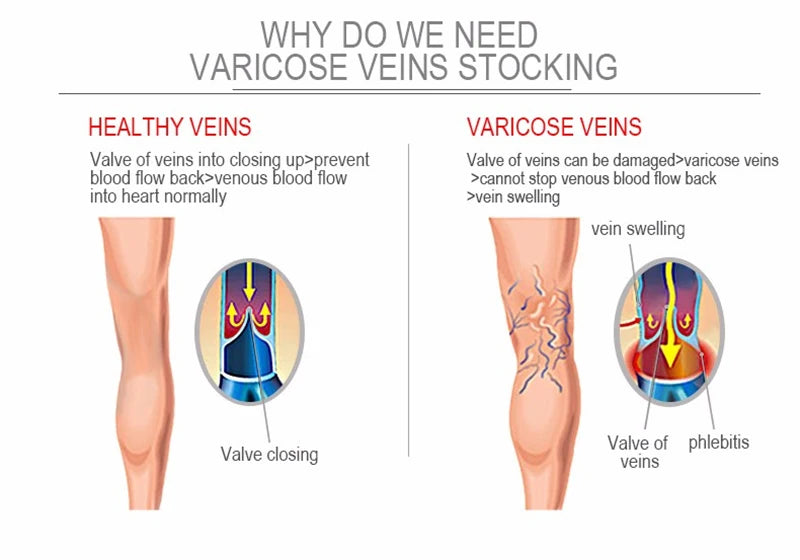 Compression Socks for Sports & Circulation