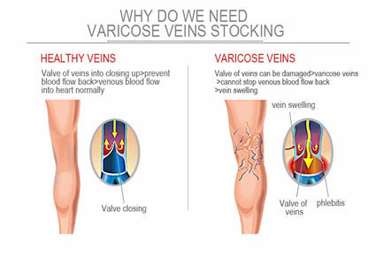 Compression Socks for Sports & Circulation